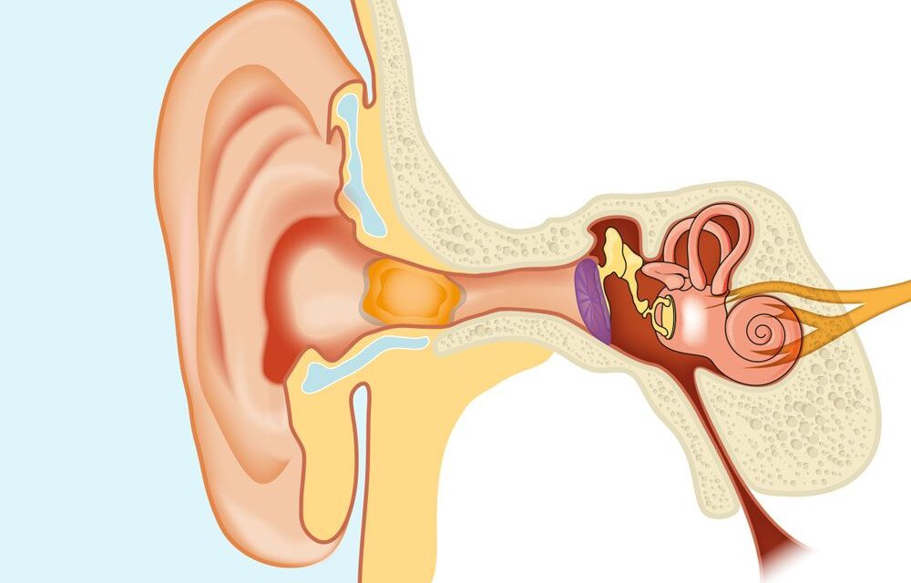 Ear wax buildup