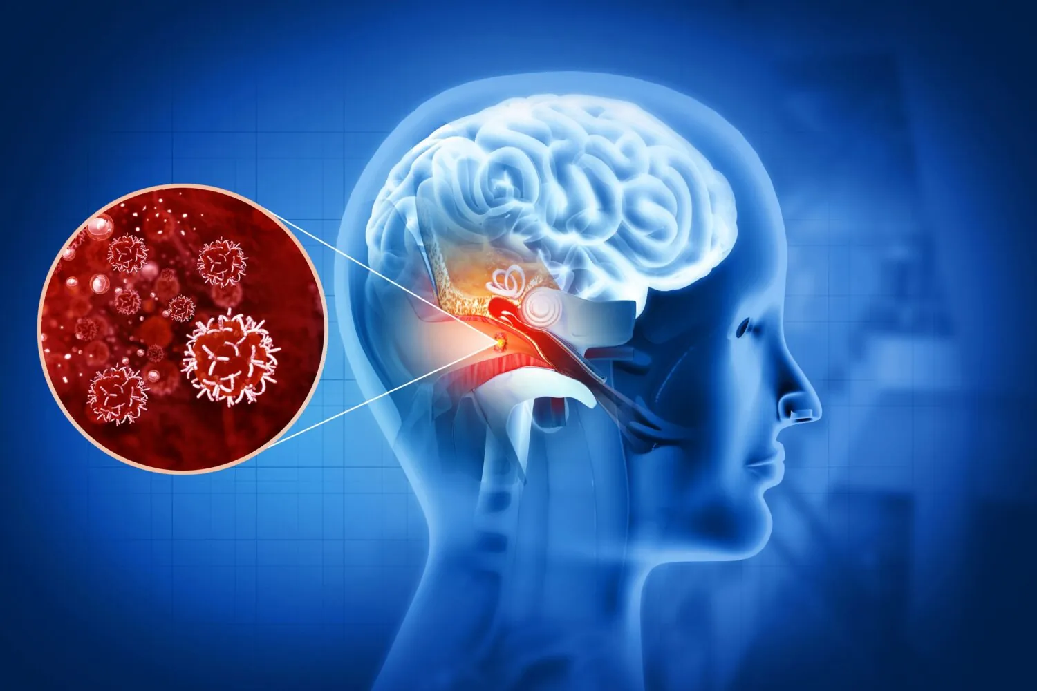 Ear infections and hearing loss